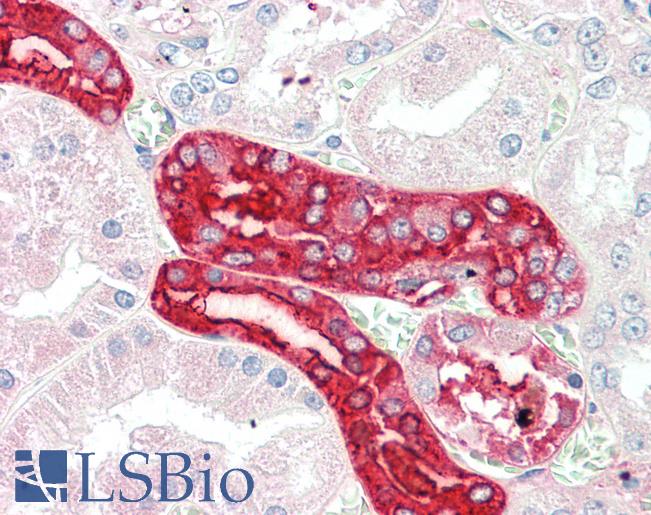 Goat Anti-MEX3C (aa541-554) Antibody