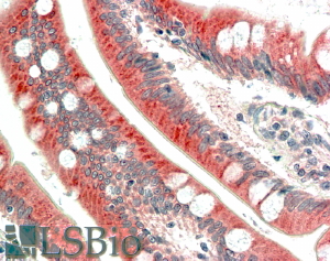 Goat Anti-MIC1 / C18orf8 Antibody