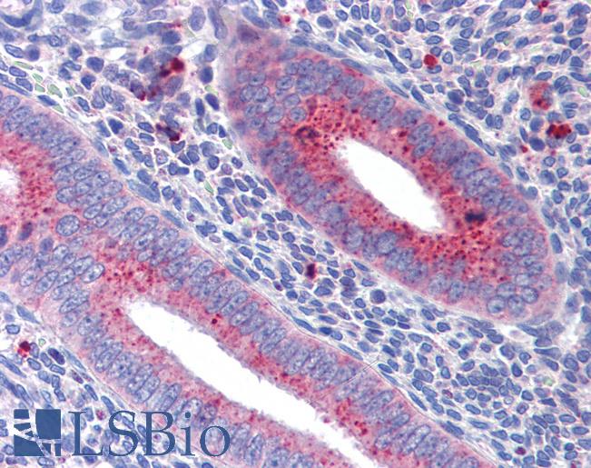 Goat Anti-Mitofusin 1 Antibody