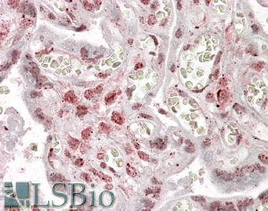 Goat Anti-MLX Antibody