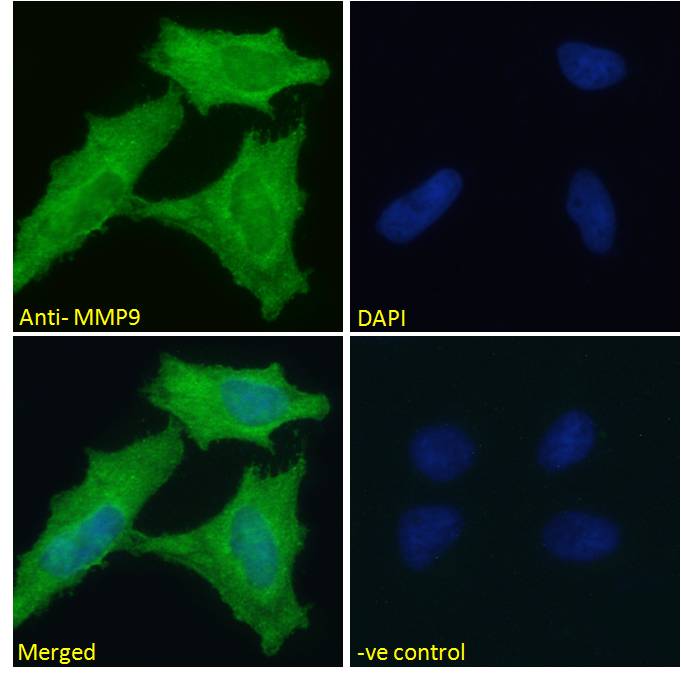 Goat Anti-MMP9 Antibody