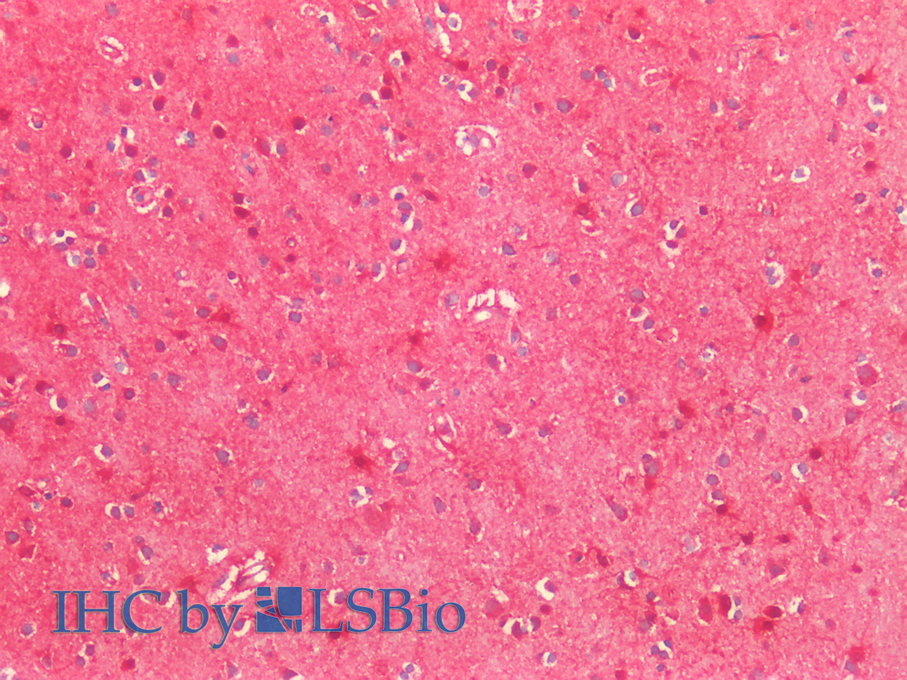 Goat Anti-MNSOD (isoform A) Antibody