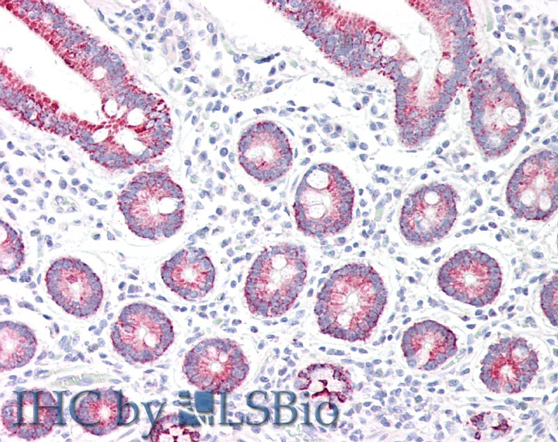 Goat Anti-Monoamine Oxidase A Antibody