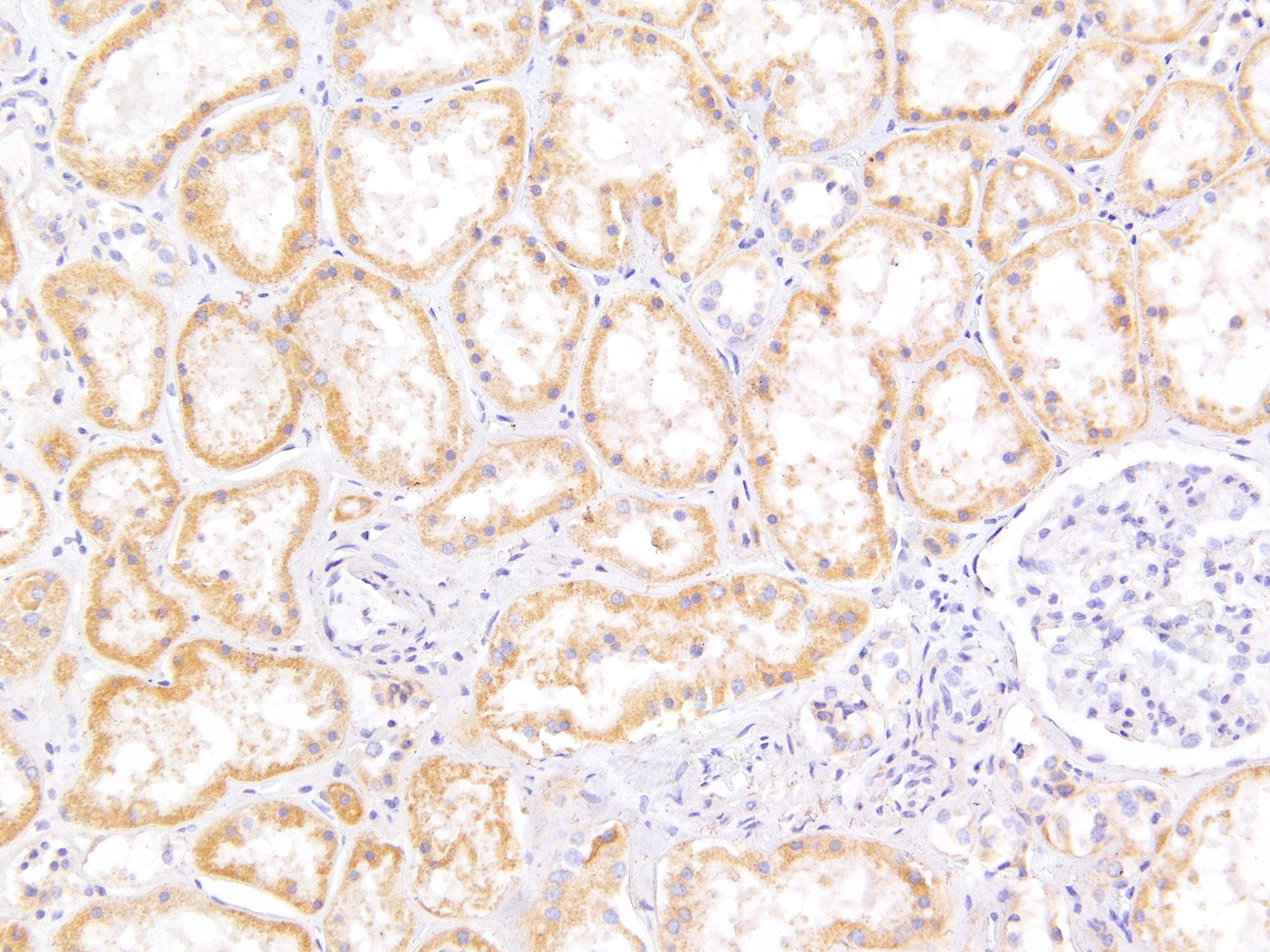 Goat Anti-MRP5 Antibody