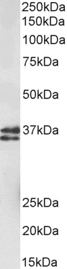 Goat Anti-MSI2 / musashi-2 Antibody