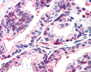 Goat Anti-MSX1 Antibody