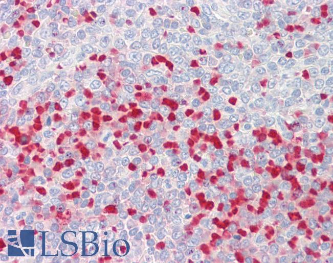 Goat Anti-MTHFR Antibody