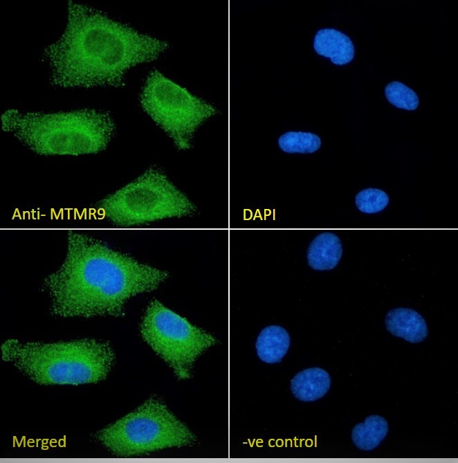Goat Anti-MTMR9 (C Terminus) Antibody