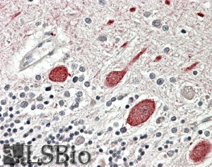 Goat Anti-MTNR1B Antibody