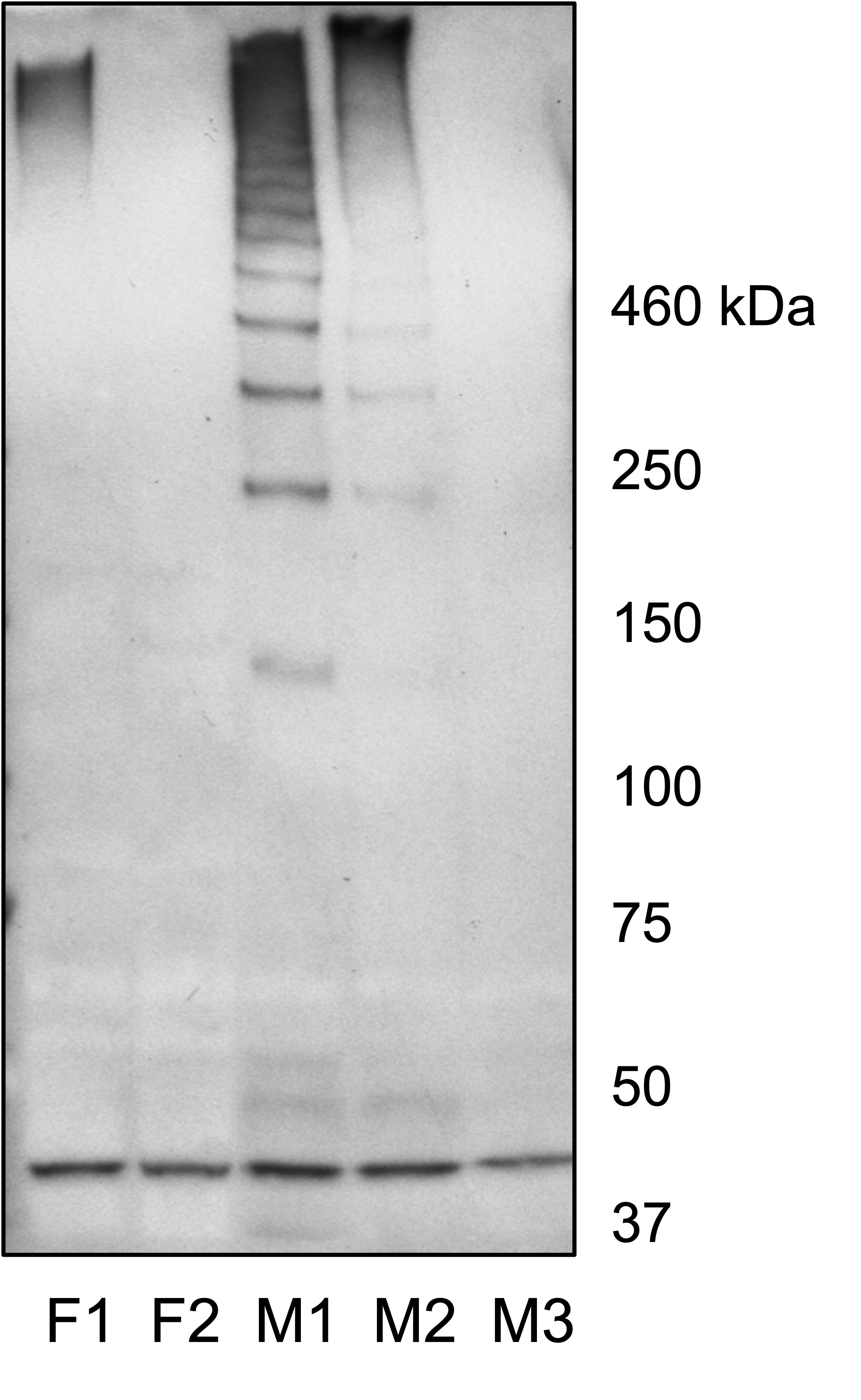 Goat Anti-Mucin 19 / Apomucin Antibody