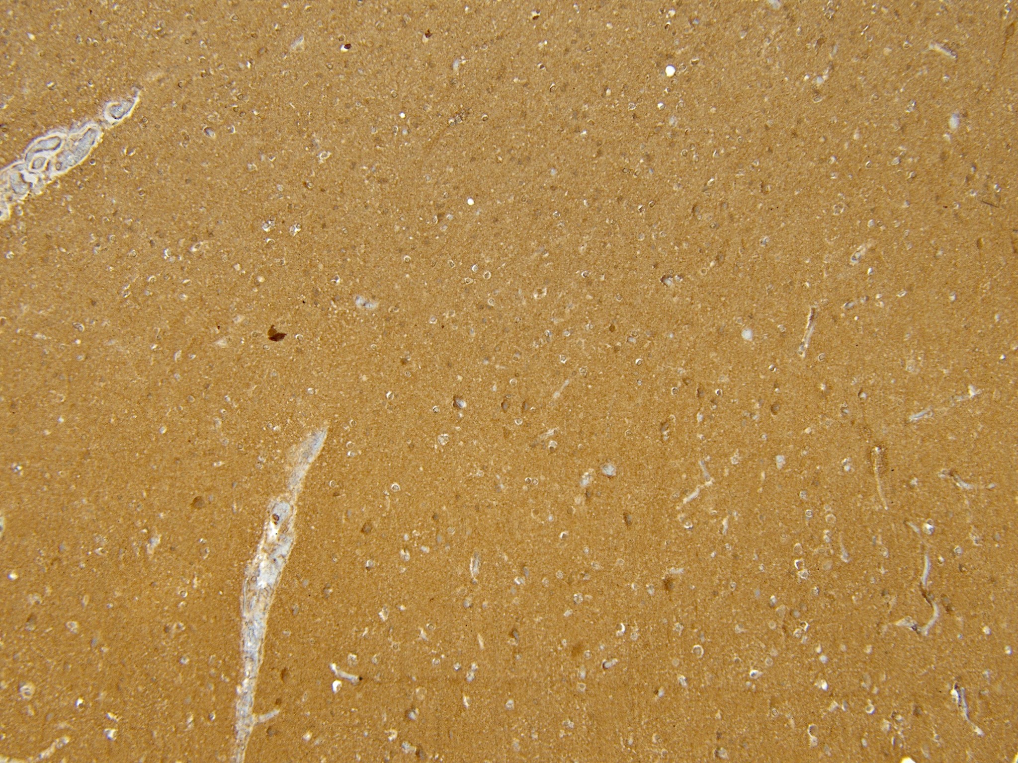 Goat Anti-MUNC18 / STXBP1 (isoform a) Antibody