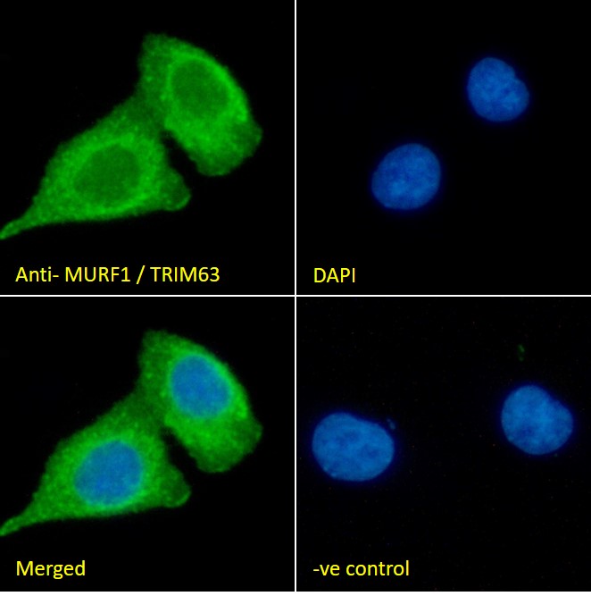 Goat Anti-MURF1 / TRIM63 (N Term) Antibody