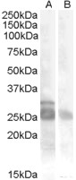 Goat Anti-MYF5 Antibody