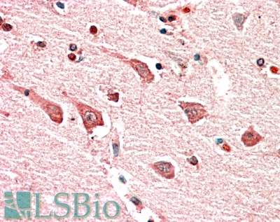 Goat Anti-MYO1B Antibody