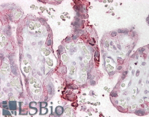 Goat Anti-NCE2 / UBE2F Antibody
