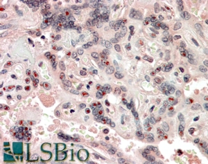 Goat Anti-NCOA3 Antibody