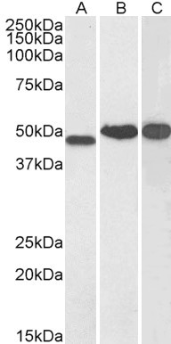 Goat Anti-NDRG1 Antibody