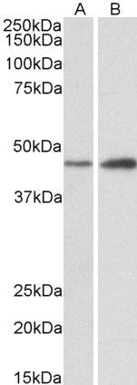 Goat Anti-NDRG2 Antibody