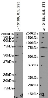 Goat Anti-NDUFS1 Antibody