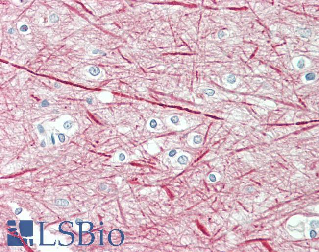 Goat Anti-NEFM / NF-M Antibody