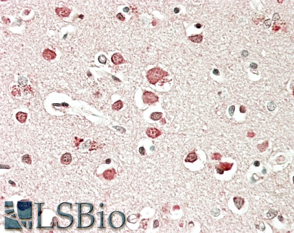 Goat Anti-Neurobeachin Antibody