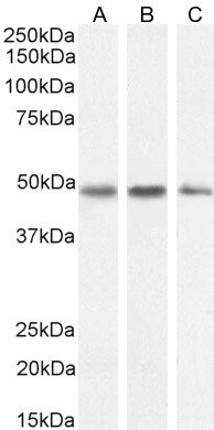Goat Anti-Neuroserpin Antibody