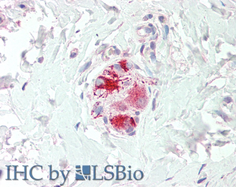 Goat Anti-Neurturin Antibody