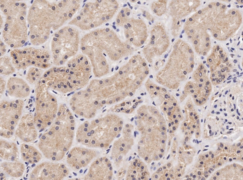 Goat Anti-NIPBL (aa889-902) Antibody