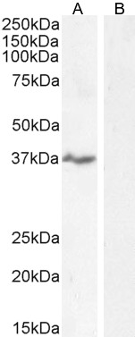 Goat Anti-NKG2D / KLRK1 Antibody