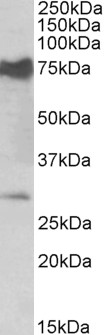 Goat Anti-Nmnat3 (mouse) Antibody