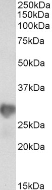 Goat Anti-NNMT (aa171-182) Antibody