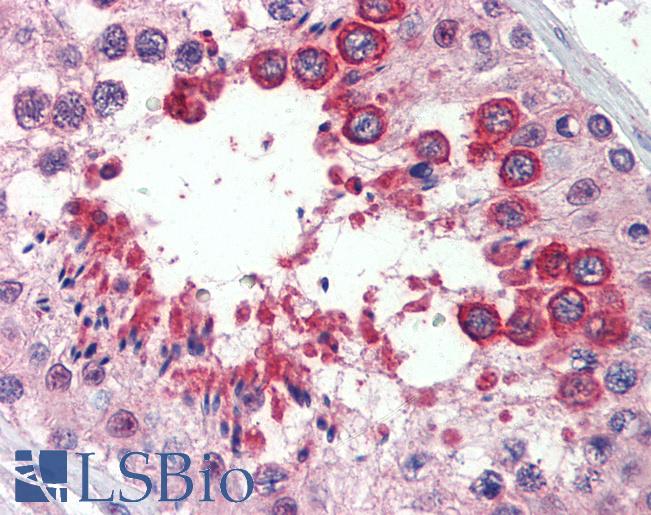 Goat Anti-NOGO-A / Reticulon 4 Antibody