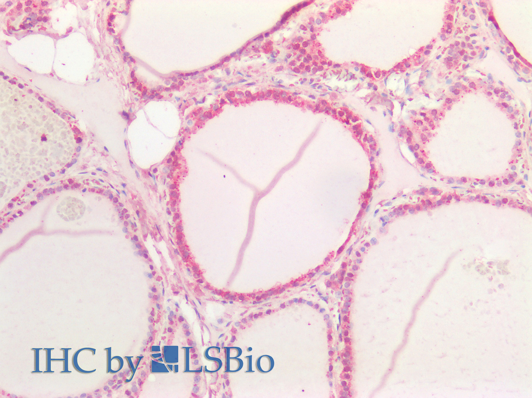 Goat Anti-NOTCH1 (aa171-182) Antibody