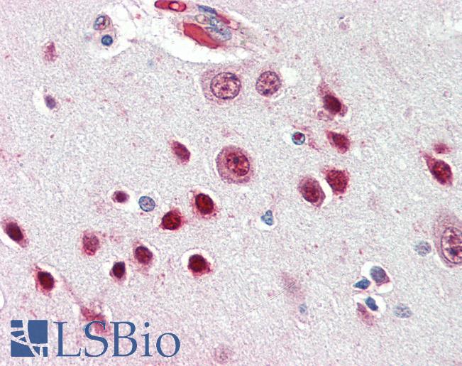 Goat Anti-NOVA1 Antibody