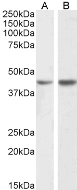 Goat Anti-NPHS2 / SRN1 Antibody