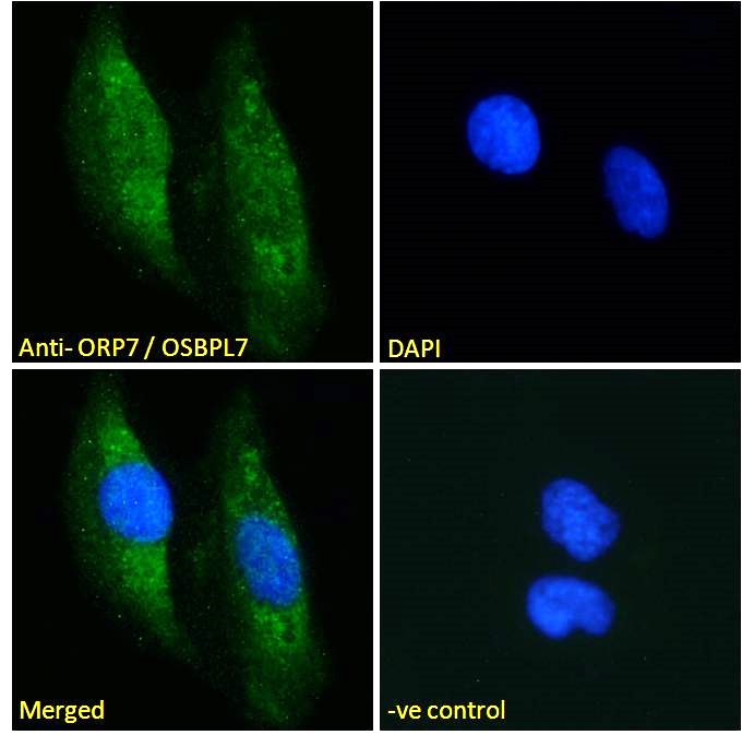 Goat Anti-ORP7 / OSBPL7 Antibody