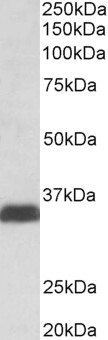 Goat Anti-Osteopontin / SPP1 Antibody