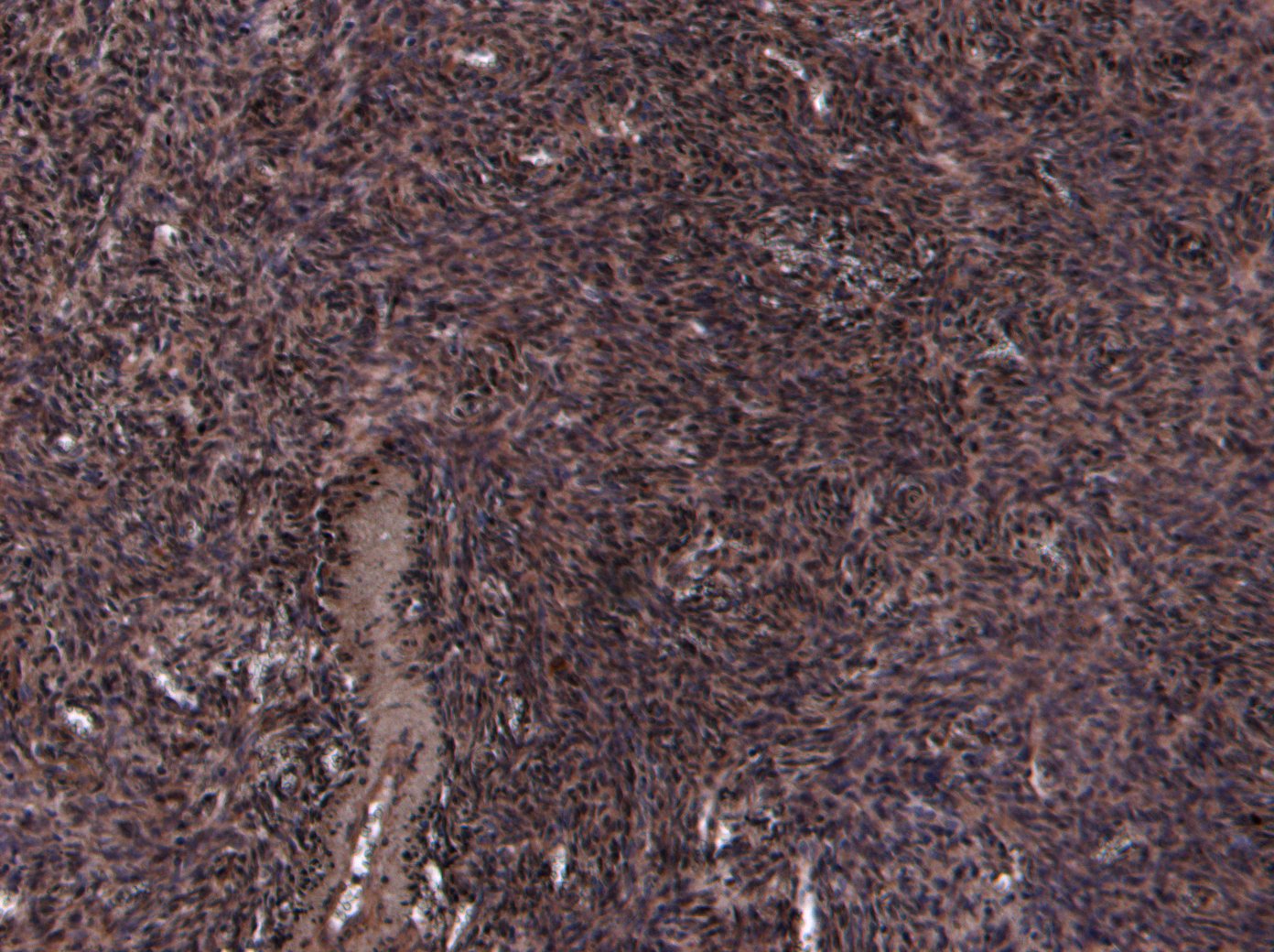 Goat Anti-Oxytocin Receptor Antibody