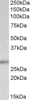 Goat Anti-P27KIP1 / CDKN1B (C Terminus) Antibody