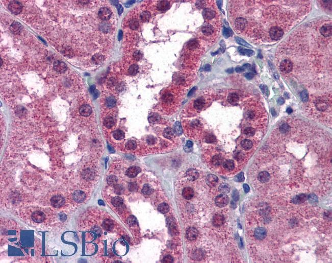 Goat Anti-P2RX7 / P2X7 receptor Antibody