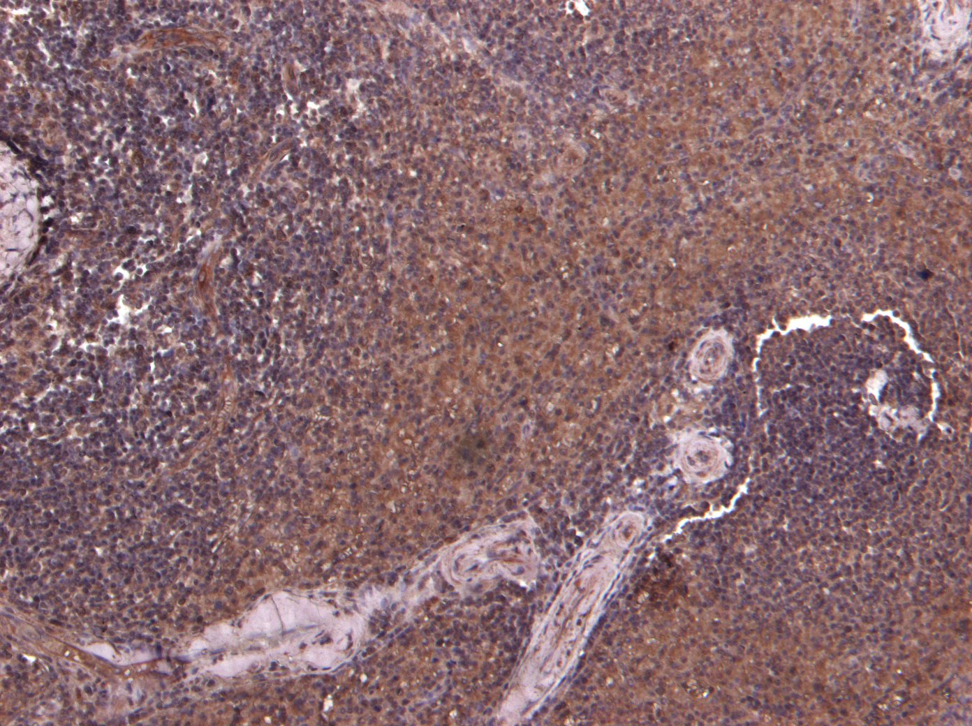 Goat Anti-P4HA1 Antibody