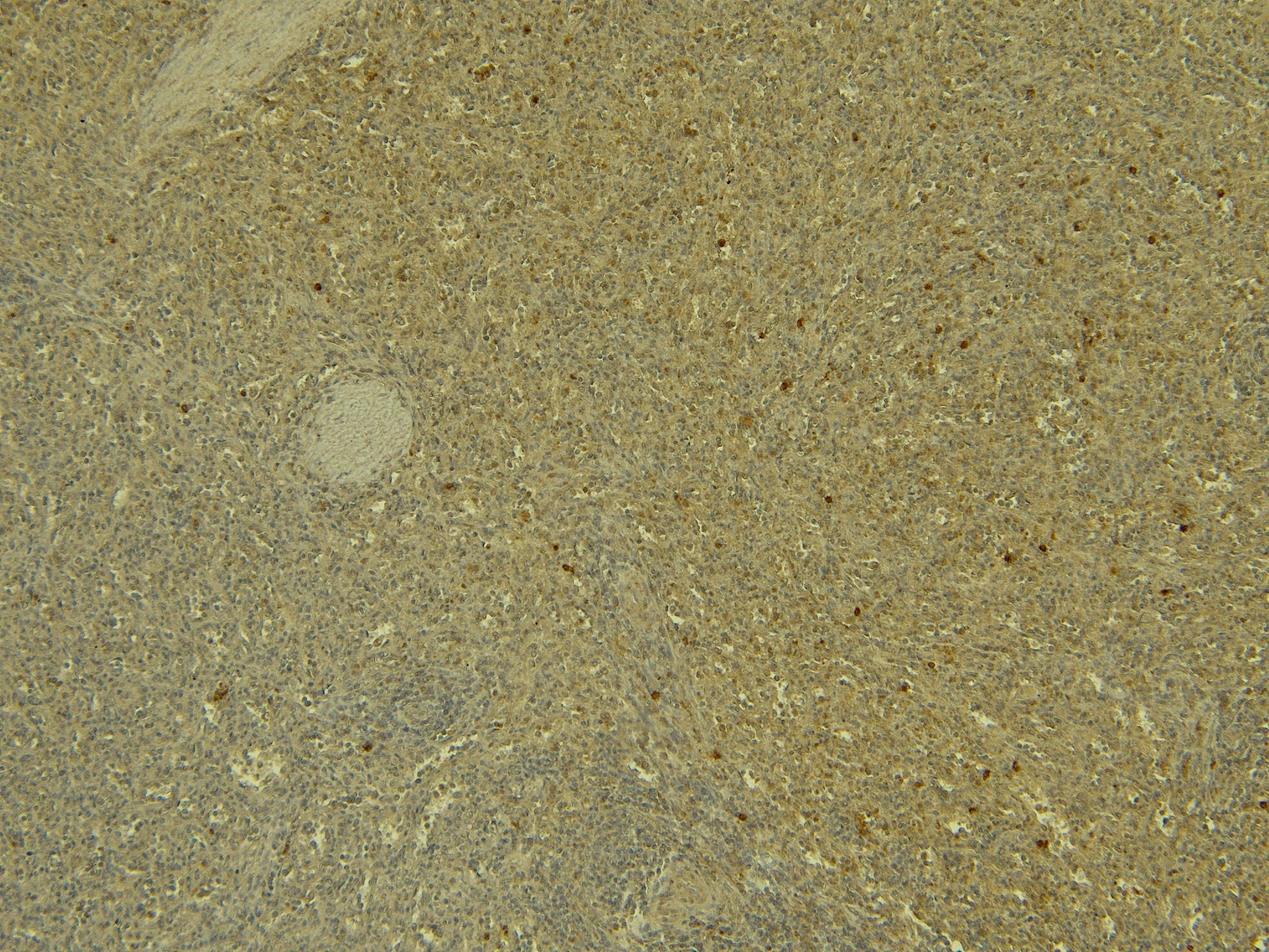 Goat Anti-PAD4 / PADI4 Antibody