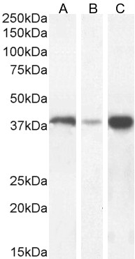 Goat Anti-pan ADH (N terminus) Antibody