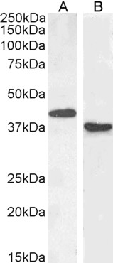 Goat Anti-PAX5 / BSAP Antibody