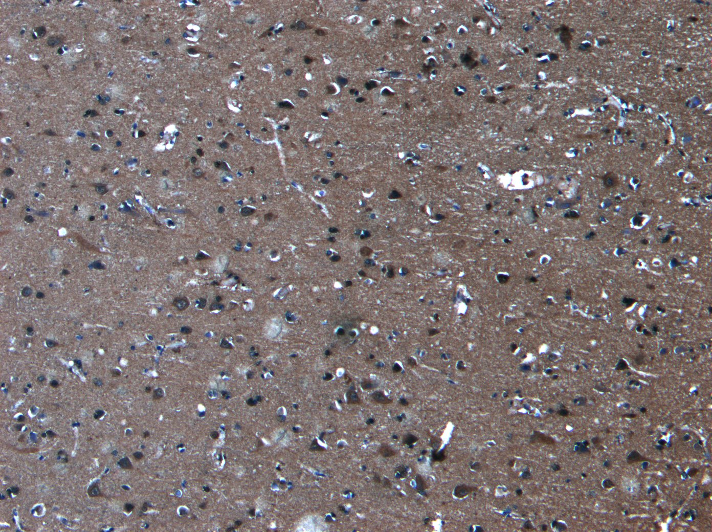 Goat Anti-PCDH11Y / PCDH11X Antibody