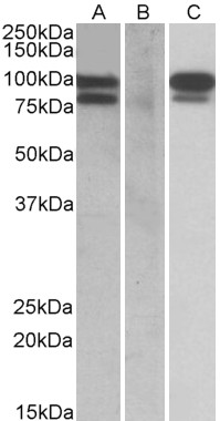 Goat Anti-PCSK9  (aa164-175) Antibody