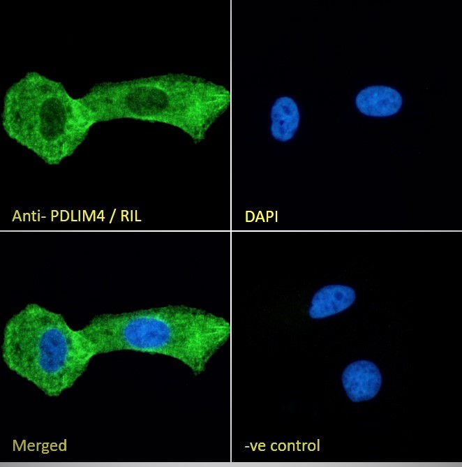 Goat Anti-PDLIM4 / RIL Antibody