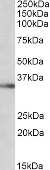 Goat Anti-PDX1 / IPF1 (aa4-18) Antibody