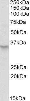 Goat Anti-PEX2 / PXMP3 Antibody