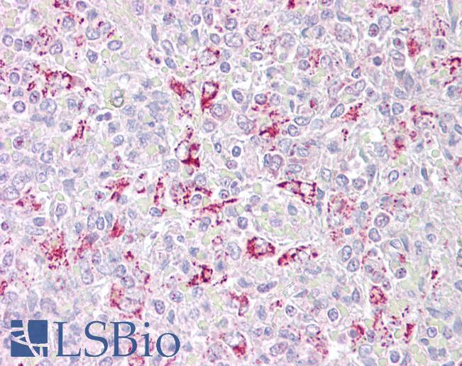 Goat Anti-PFKFB2 Antibody